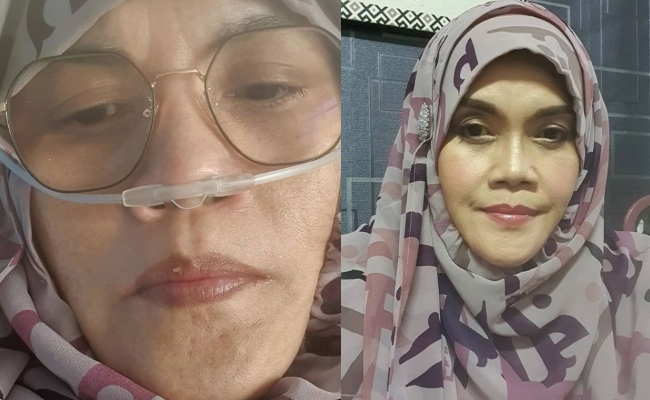 Tahap Oksigen Turun Mendadak, Aishah Risau Terpaksa Ditidurkan – ‘Saya Masih Banyak Tanggungjawab Kepada Keluarga & Anak-Anak’