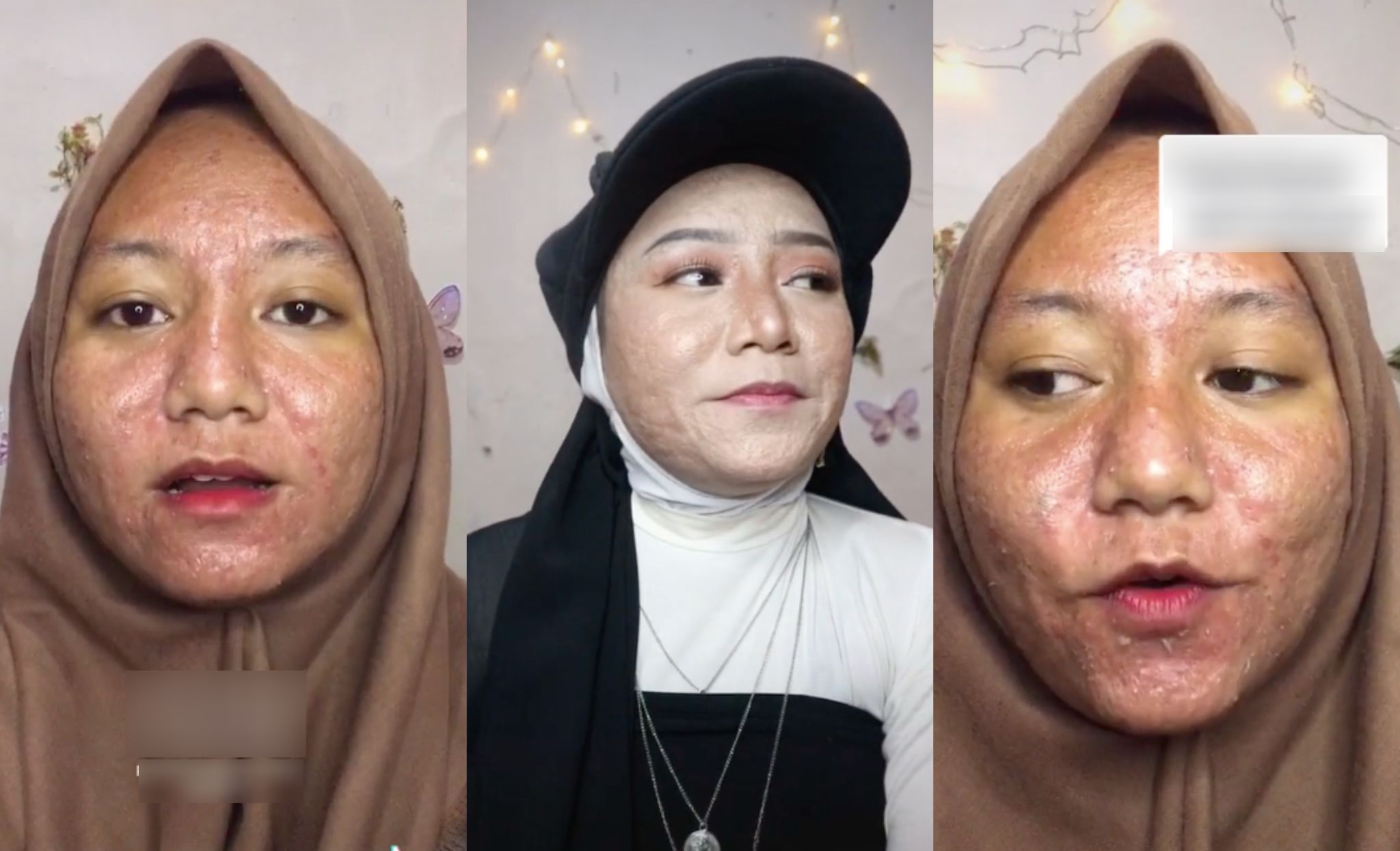 [VIDEO] Dihina Muka Berjerawat Teruk, Gadis Tak Hirau Komen Negatif & Tetap Hasilkan Make-Up Terbaik