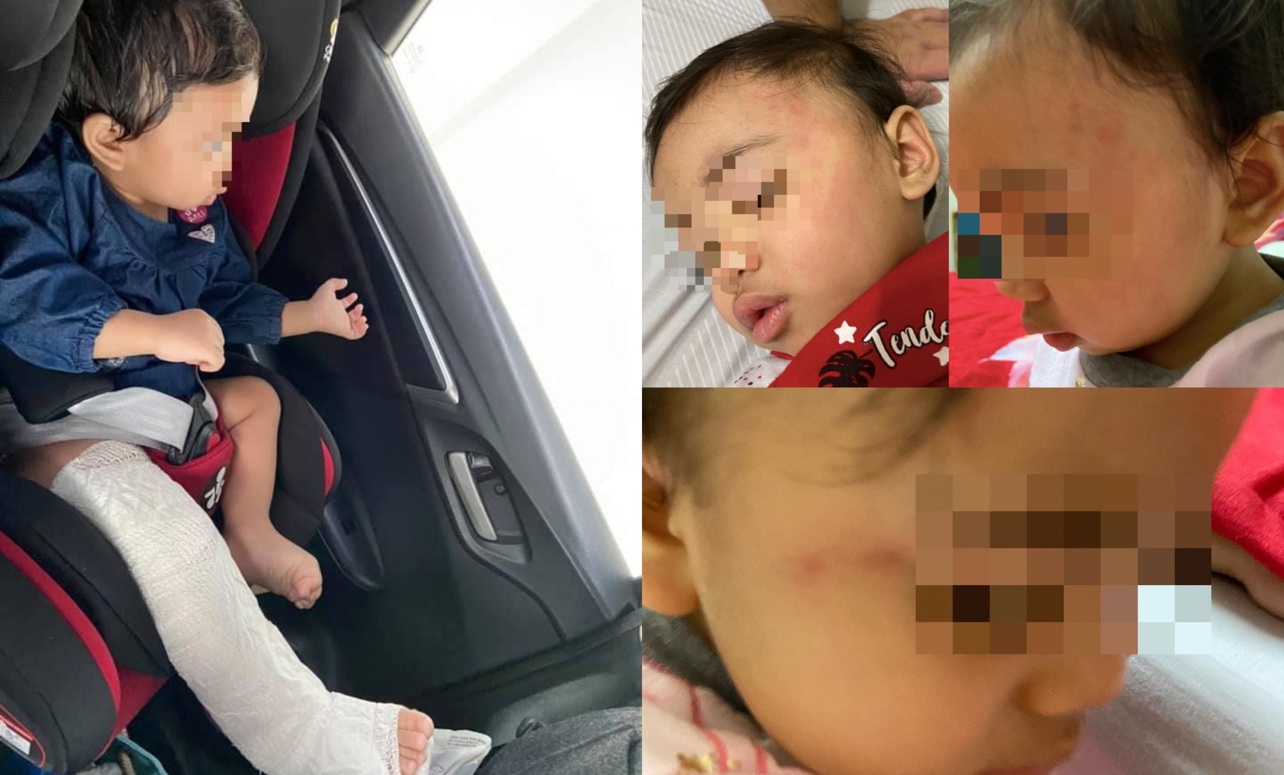 Bayi Dipercayai Didera Di Tempat Asuhan, Hasil X-Ray Nampak Kesan Retak – ‘Video CCTV Banyak Hilang…’