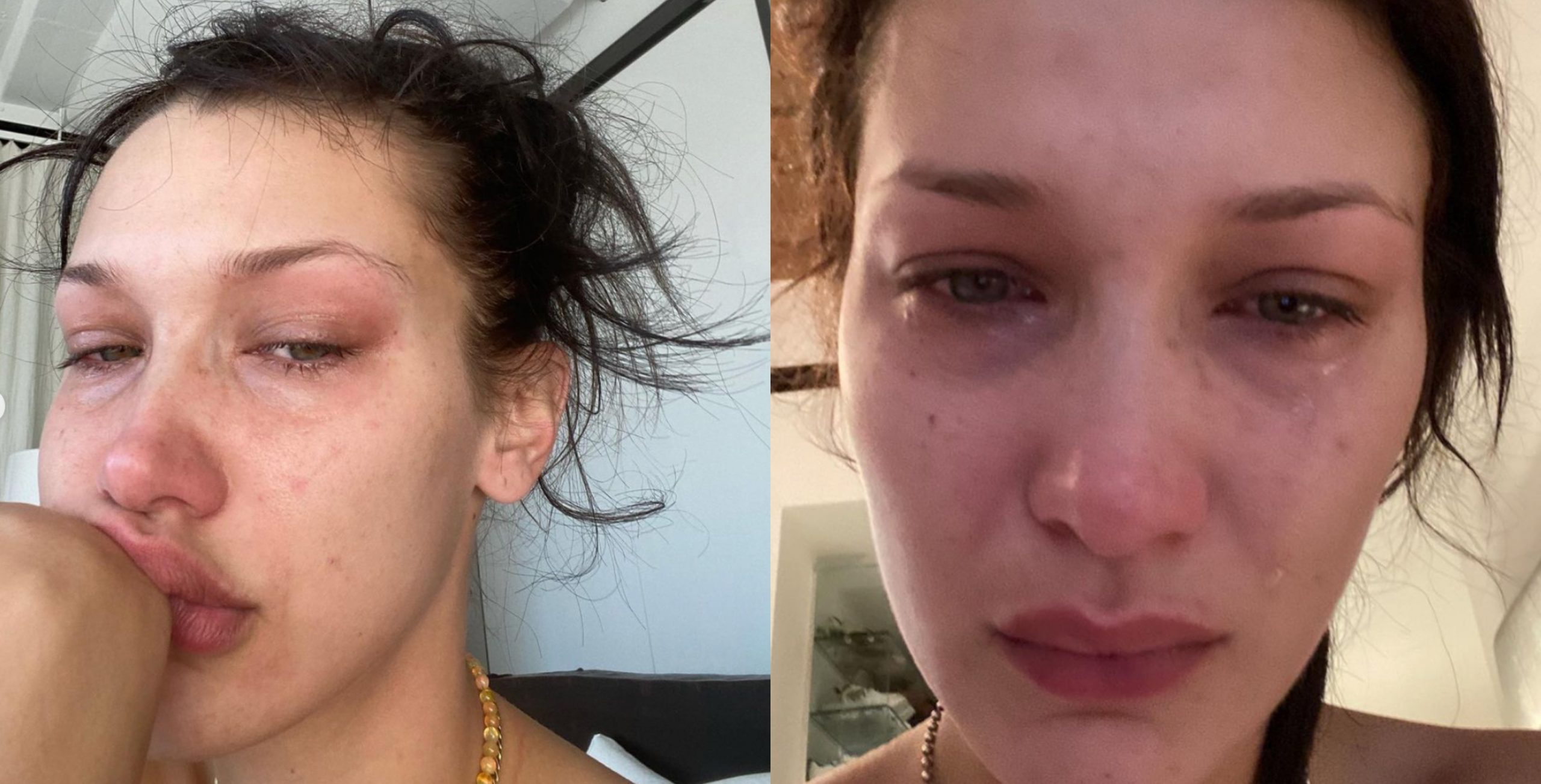 Muat Naik Foto Sedang Menangis Di IG, Bella Hadid Beri ‘Hint’ Hidap Masalah Anxiety – ‘Tolong Ingat Yang Anda Tidak Keseorangan’