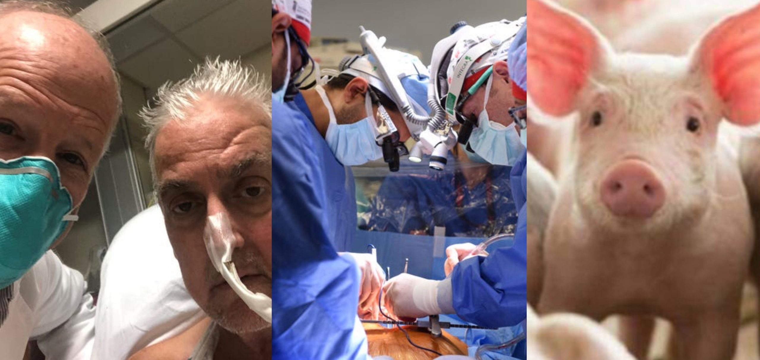 Pembedahan Berjaya, Lelaki Ini Sudah Hidup Empat Hari Pakai Jantung Babi