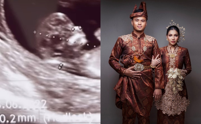 Selit Gambar Imbasan Ultrabunyi Dalam Video, Elisya Sandha Hamil Anak Pertama?