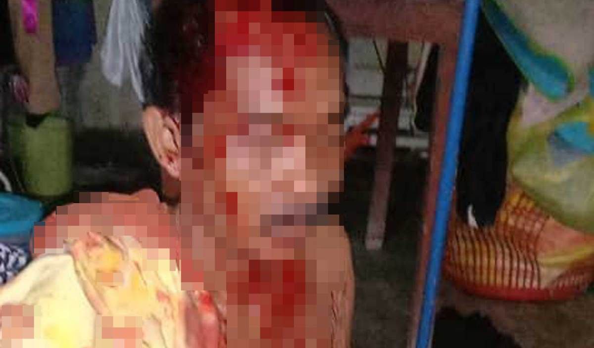 Lelaki Dipukul Sehingga Parah Selepas Tegur Anak Saudara Ambil Ubat Nyamuk 5