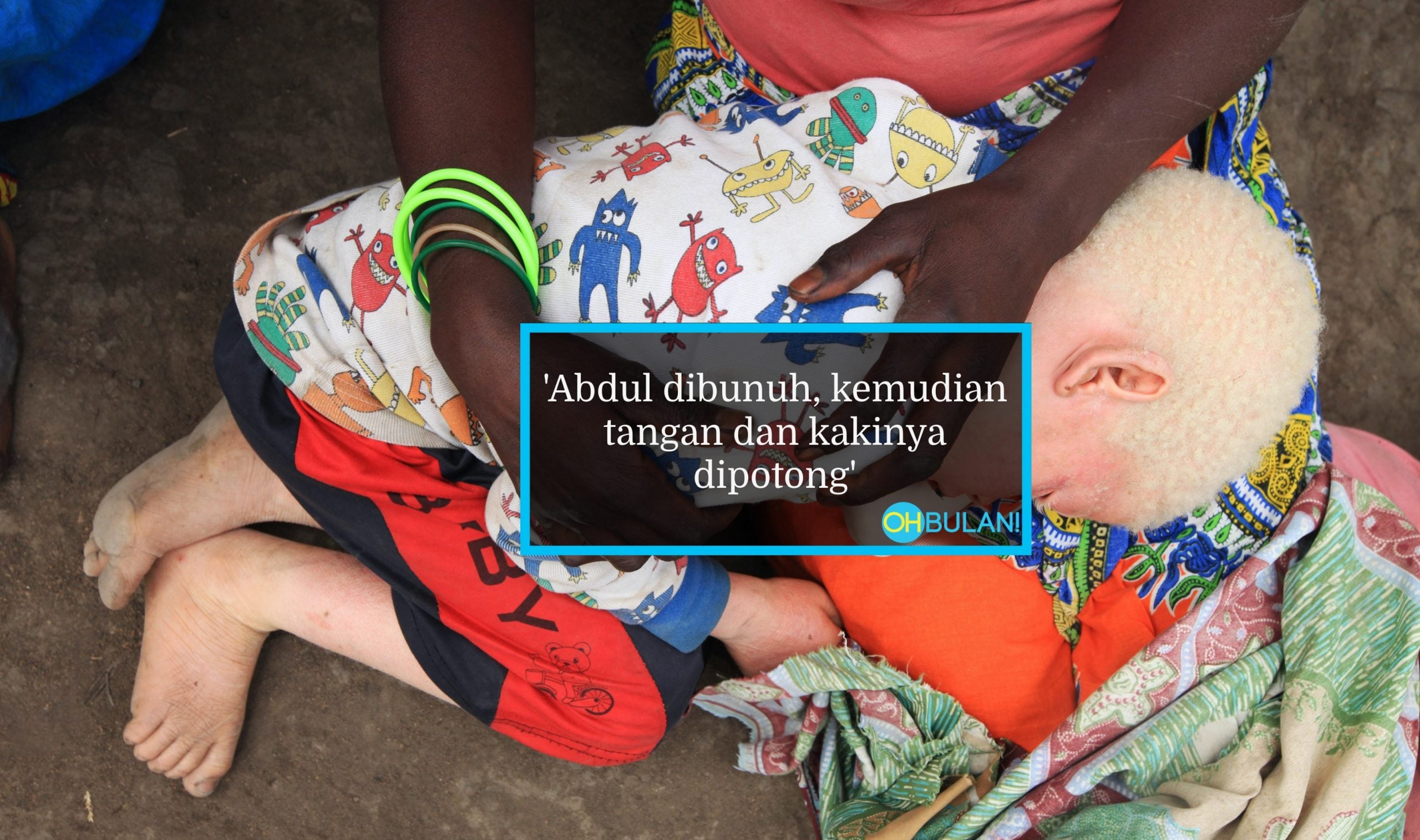 Budak Albino 4 Tahun Dibunuh, Badan Dikerat & Tulang Dikeluarkan, Mayat Dibuang Ke Dalam Hutan