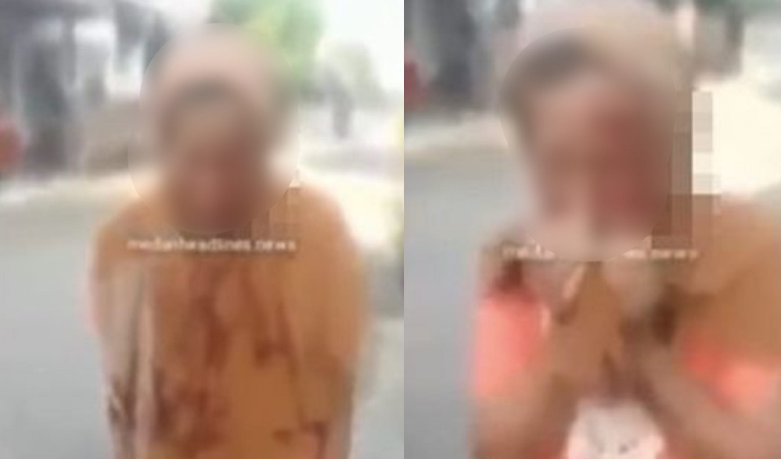 Berang Tak Dapat RM5, Anak Baling Telefon Pada Wajah Ibu Kandung Hingga Berdarah