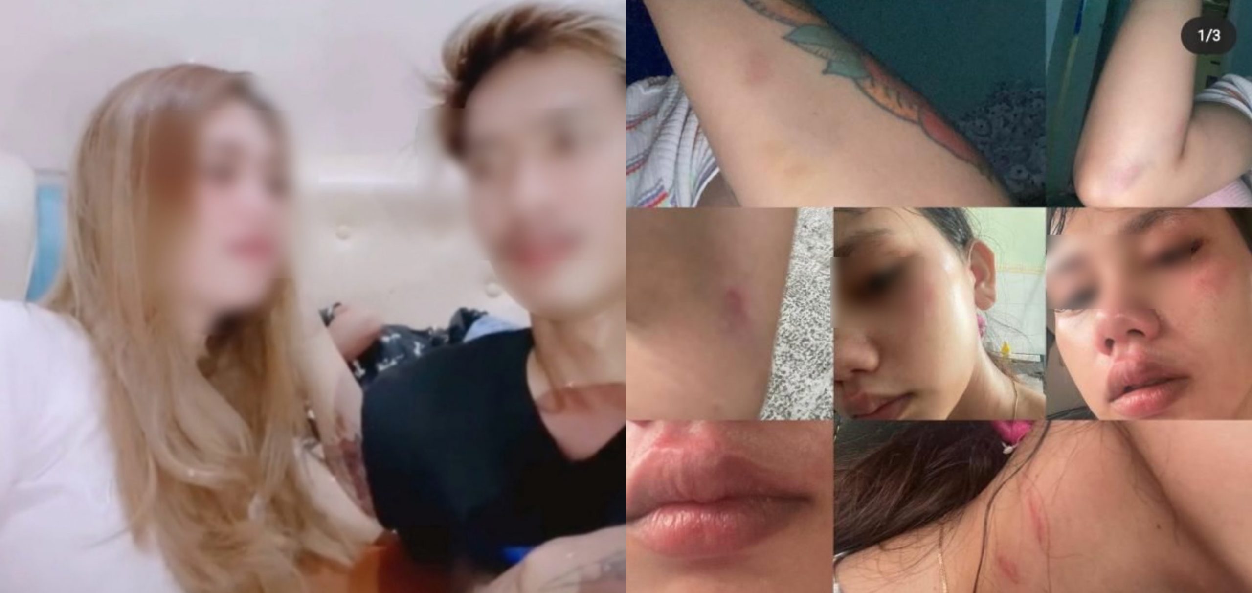 [VIDEO] Masih Maafkan Walau Dipukul Di Perut Ketika Hamil, Youtuber ‘Serik’ Rujuk Semula Dengan Suami Demi Anak