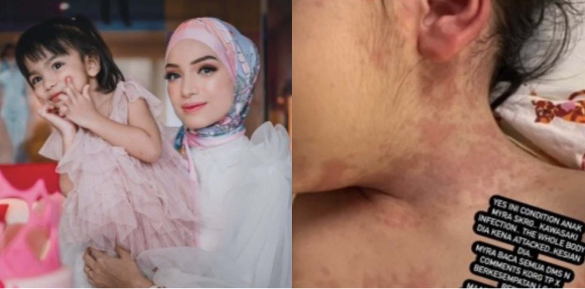 Tahap Oksigen Tiba-Tiba Turun, Rakan Artis Doa Anak Amyra Rosli Segera Sembuh