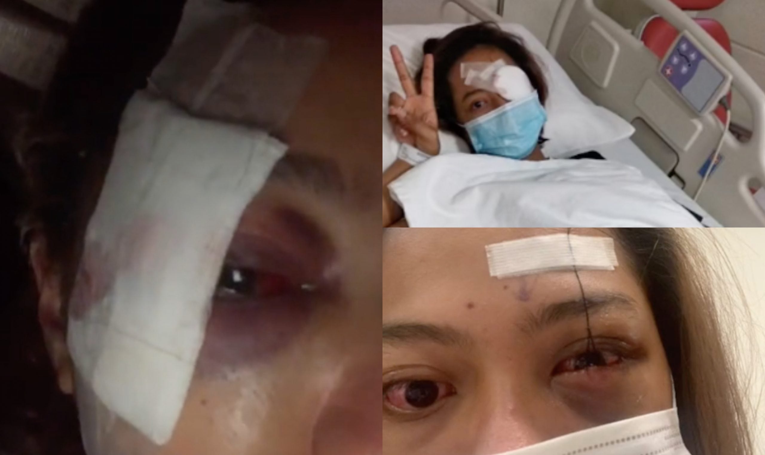 2 Kali Dapat Teman Lelaki Panas Baran, 2 Kali Kena Pukul