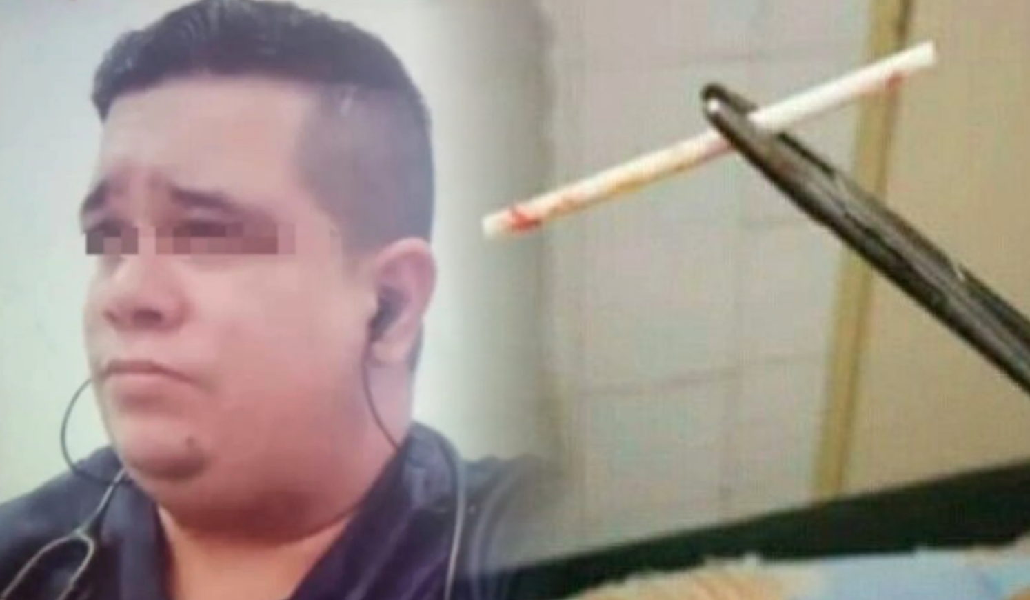 Doktor Palsu Tanam Batang Lolipop Bawah Lengan Wanita, Kononnya Alat Pencegah Kehamilan