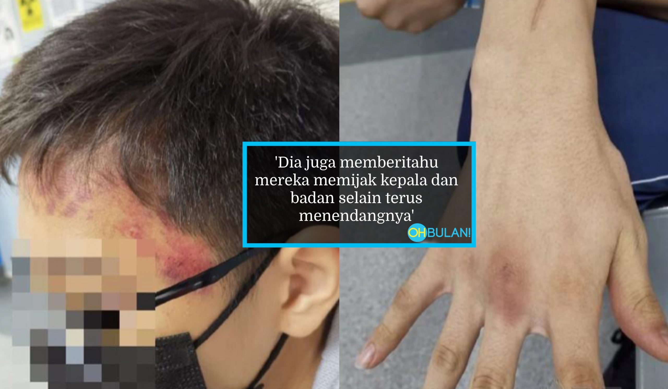 ‘Kepala Ditendang Seperti Bola’– Bapa Kecewa Anak Dibuli 10 Pelajar, Bila Buat Aduan, Pengetua Kata Benda Boleh ‘Settle’