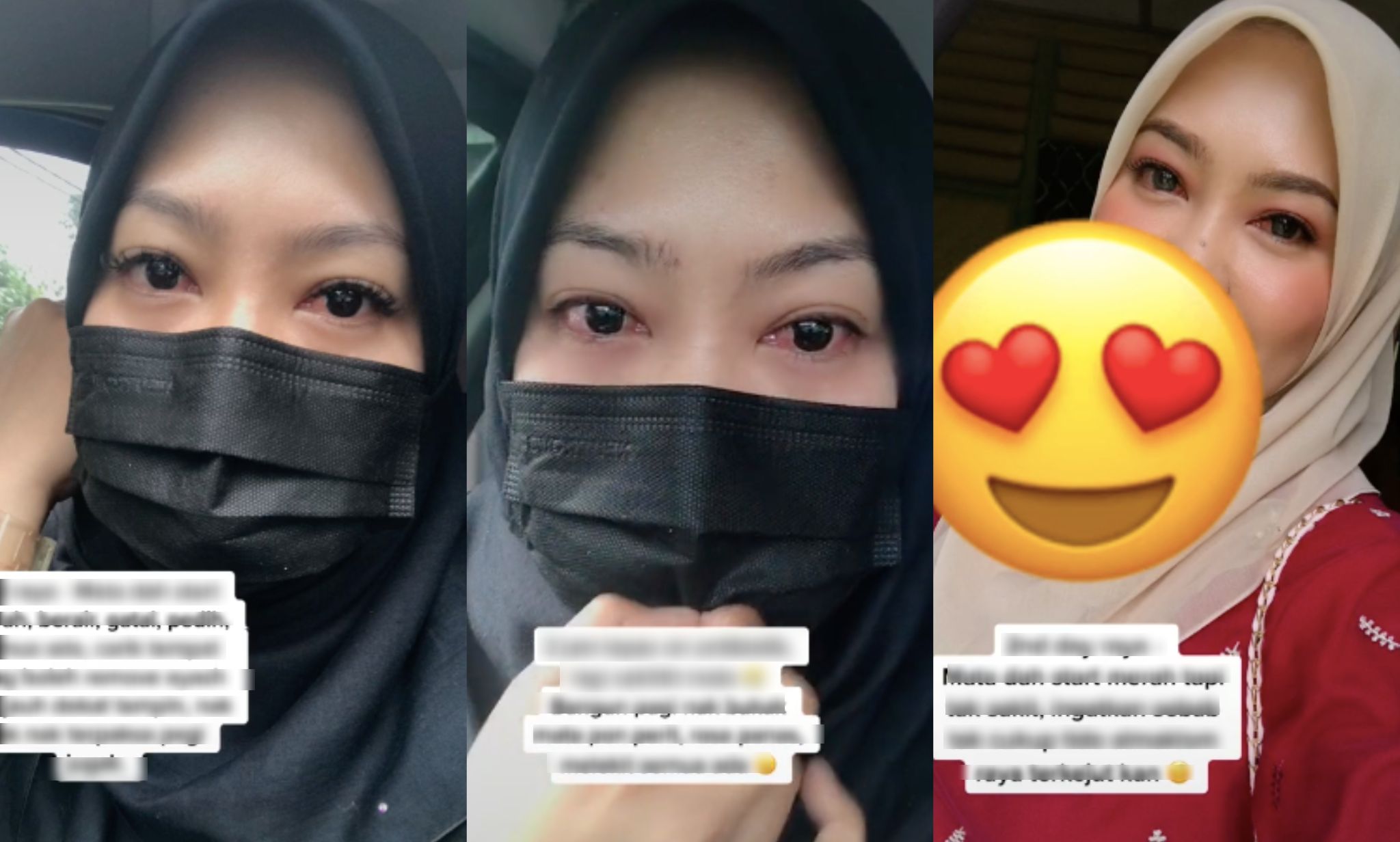 Pakai ‘Eyelash Extension’ Masa Raya, Wanita Trauma Mata Kena Jangkitan