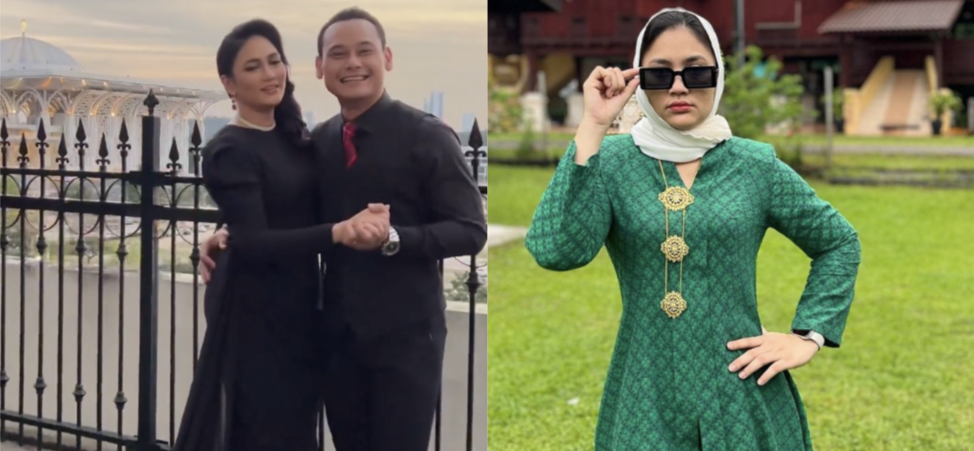 Kawal Ambil Karbohidrat & Gula, Fasha Sandha Nafi Buat Pembedahan Bariatrik