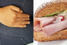 Lelaki Saman Kedai Sandwich RM1 Juta, Dakwa Punca Kentut Tanpa Henti Selama 5 Tahun