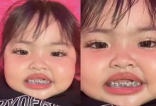 [VIDEO] Netizen Kecam Tindakan Ibu Bapa Pakaikan Anak Kecil Pendakap Gigi – ‘Kasihan Dia, Sakit Tu’