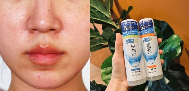 Nak Kulit Sihat Dan Cantik Secara Semulajadi? Skin Barrier Kenalah Sihat Juga!