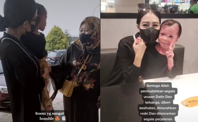 [VIDEO] Tak Kekok Layan Kanak-Kanak Sakit Kulit, Netizen Puji Eina Azman – ‘Dia Tak Kongsi Pun Dekat Instagram’