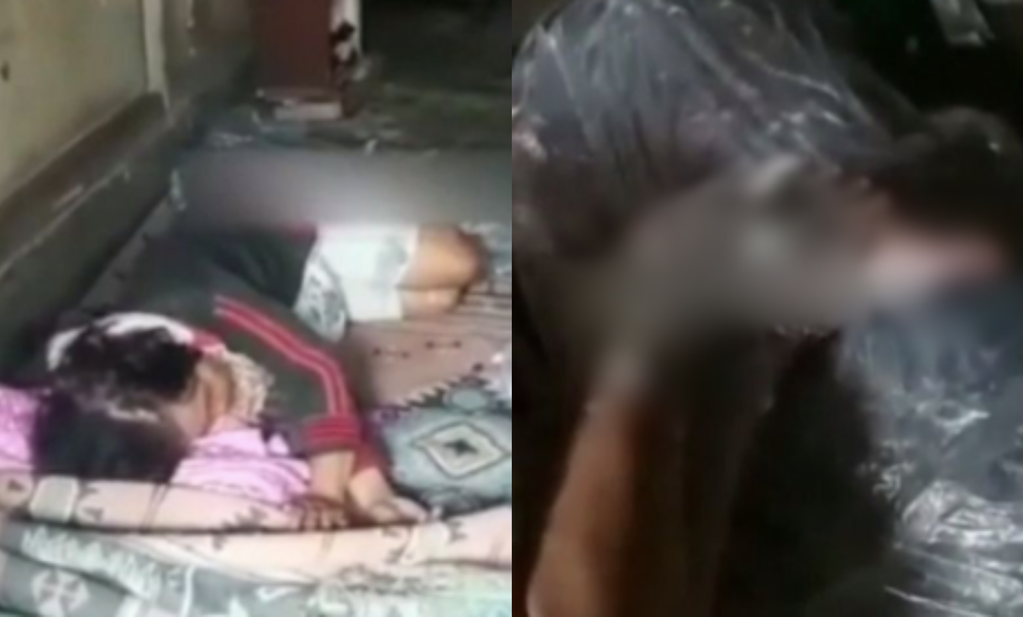 Sakit Hati Adik Habiskan Mi Segera, Lelaki Tergamak Bakar Kaki Ibu
