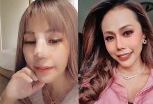 [VIDEO] Kos Hidung Cecah RM166,000, Lana Nordin Guna Tulang Rusuk Untuk Pembedahan Kali Keempat