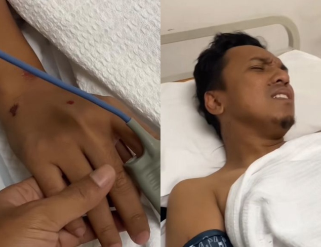 Fad Bocey Kemalangan, Alami Hentakan Di Kepala Dan Perlu Dipantau Rapi