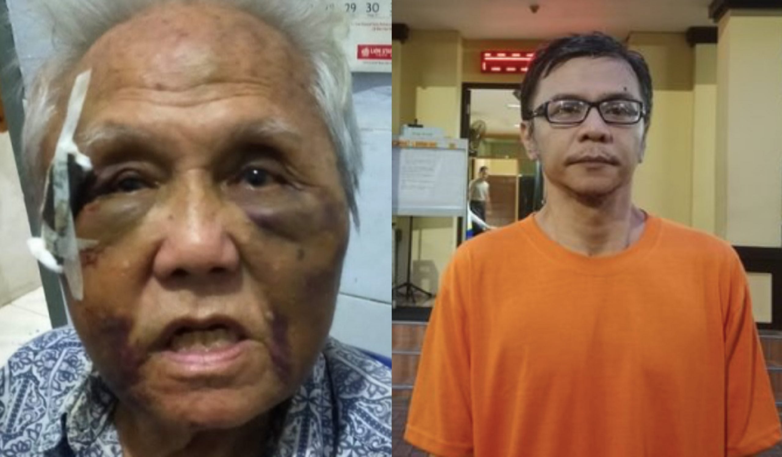 Anak Pukul Bapa Umur 83 Tahun Hingga Cedera Parah Sebab Tumpahkan Nasi