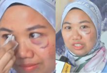 [VIDEO] Shuhada Terkejut Tengok Keputusan ‘Scanning’ Klinik, Netizen Dakwa Penyondol Hamil?