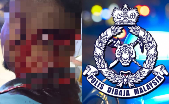 Dua Lelaki Parah Ditetak, Didakwa Kacau Isteri Orang