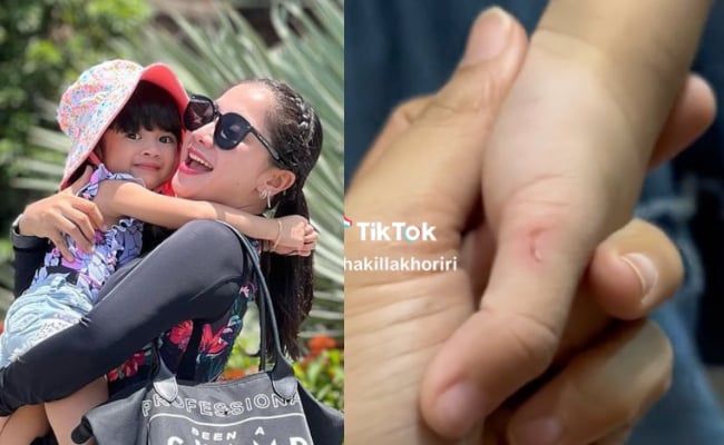 [VIDEO] ‘Makcik, Sila Hati-Hati Bila Ada Kuku Panjang’ – Jari Anak Shakilla Khoriri Luka Ketika Bersalaman Raya