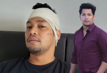 Insiden Kepala Ditetak, Kamal Adli Masih Trauma- ‘Setiap Kali Keluar Rumah, Saya Pakai Mask’