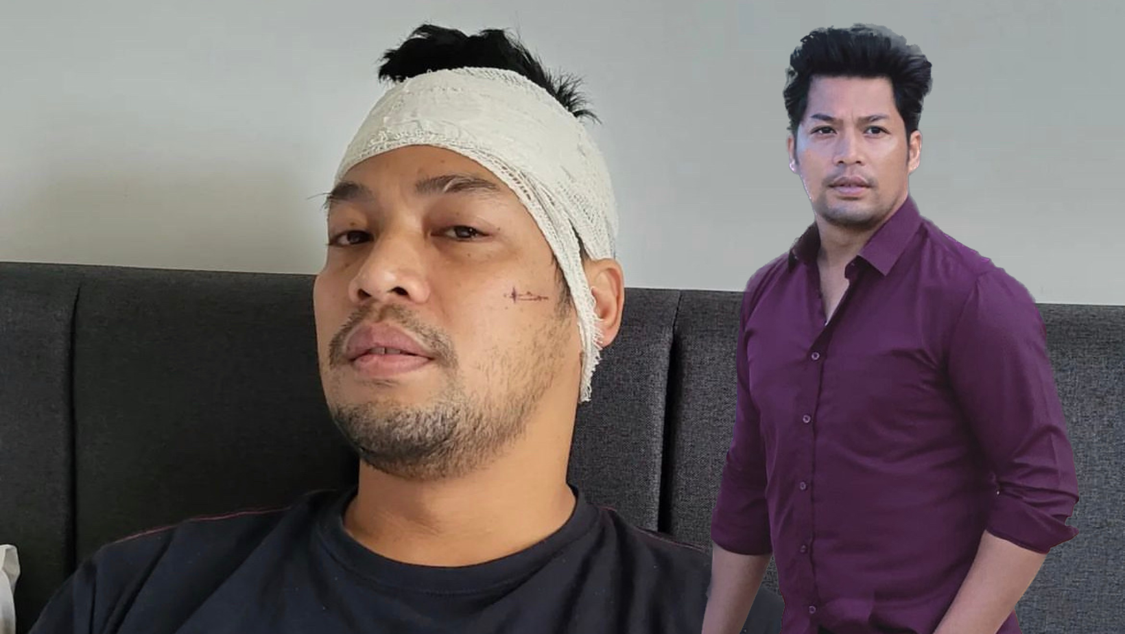 Insiden Kepala Ditetak, Kamal Adli Masih Trauma- ‘Setiap Kali Keluar Rumah, Saya Pakai Mask’