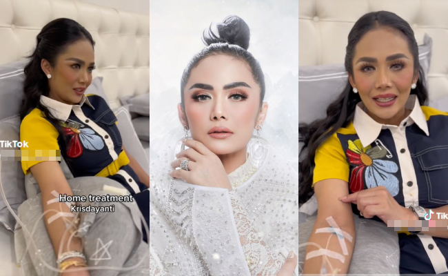 ‘Tak Effect Buah Pinggang Ke?’ – Netizen Persoal Krisdayanti Buat Rawatan Putihkan Kulit