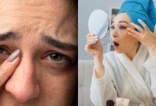 Eyebag Makin Teruk ? Jom Try 6 Tips Ni Untuk Kurangkan Mata Sembap!