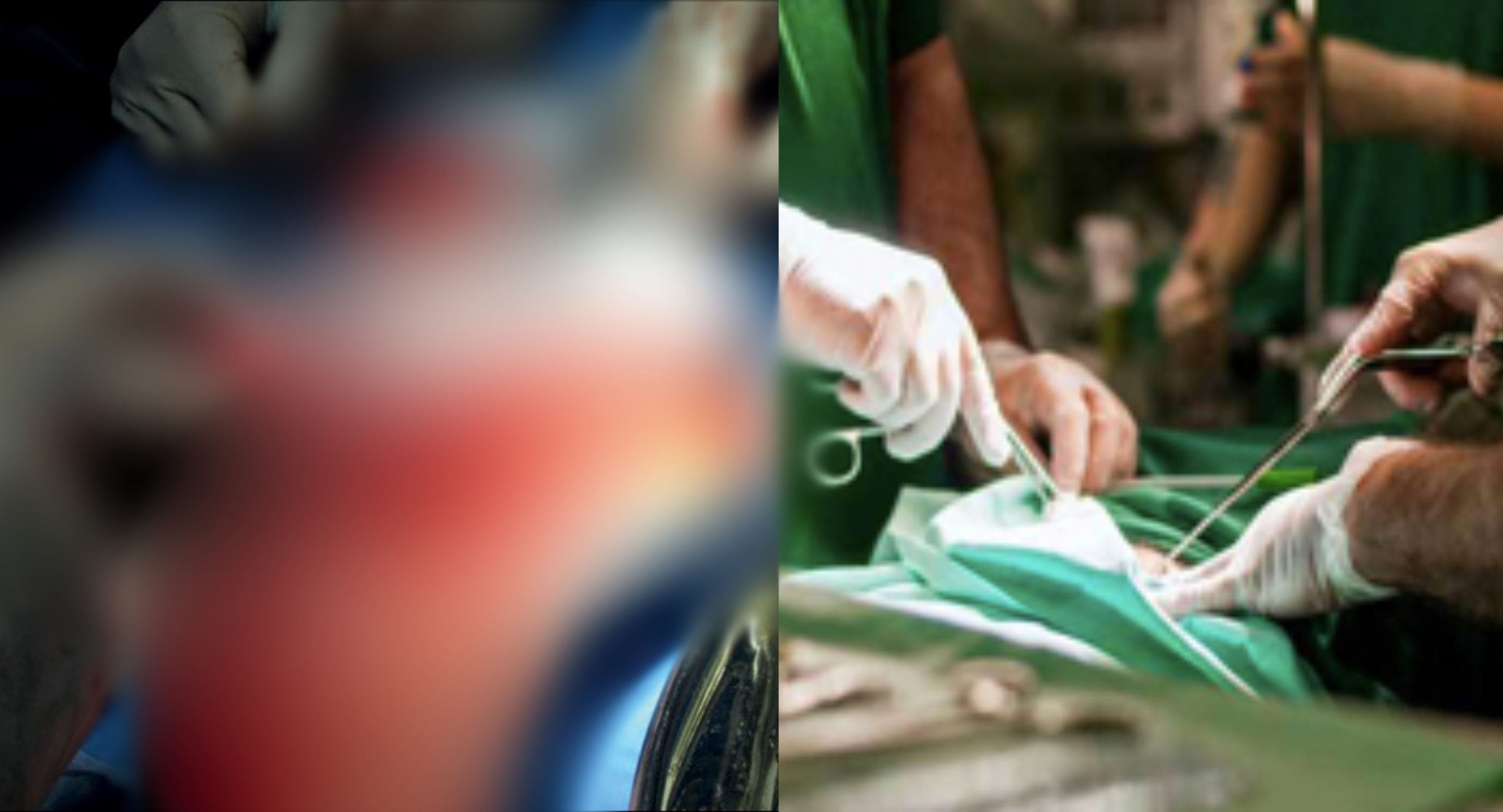 Padah Buat Seks 24 Jam Tanpa Henti, Zakar Suami Terpaksa Dipotong