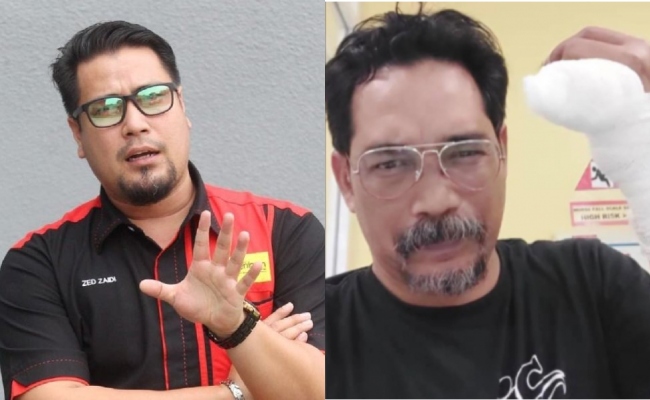 ‘Sebagai Presiden Seniman, Saya Mohon Maaf’ – Zed Zaidi Mengaku Terlepas Pandang Isu Jari Putus Shahronizam Noor