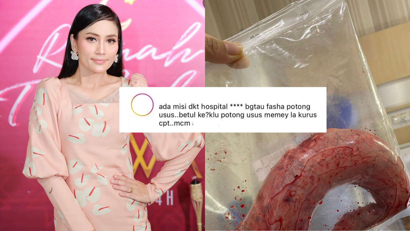 Fasha Sandha Terkilan Dituduh Kurus Sebab Potong Usus, Minta Tampilkan Bukti – ‘Research Dulu Sebelum Buat Andaian’