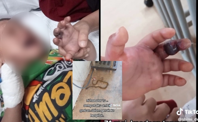 ‘Maafkan Walid Sayang’ – Bapa Kongsi Detik Cemas Tangan Anak Membiru, Dipatuk Ular Kapak Menyorok Dalam Kasut