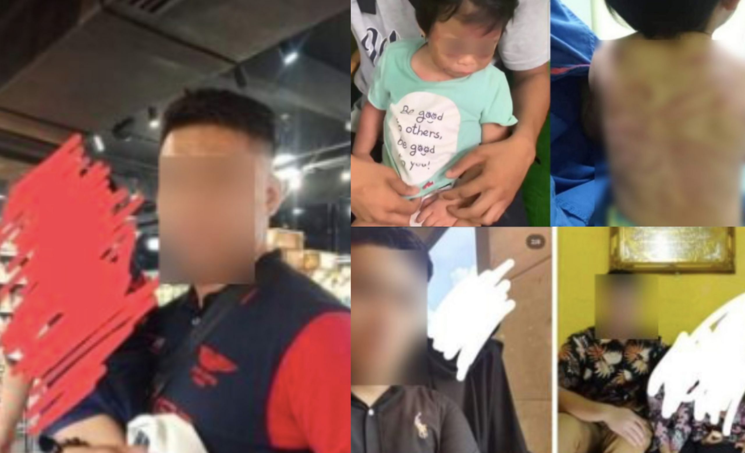 Kanak-Kanak Dua Tahun Didera Kekasih Ibu Sebab Buat Bising