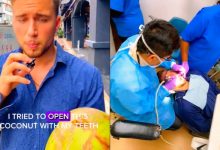 [VIDEO] ‘Mat Salleh’ Buat Konten Kupas Kelapa Guna Gigi, Sudahnya Kena Rawat Di Klinik