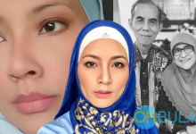 Norish Karman Nafi Cucuk Botox, Hidung & Bibir Genetik Arwah Ibu Bapa