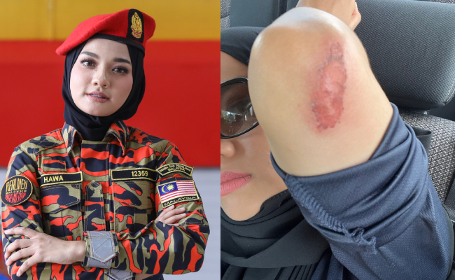 Ibu Bapa Larang Hawa Rizwana Sertai Aktiviti Lasak – ‘Saya Seorang Anak Perempuan’