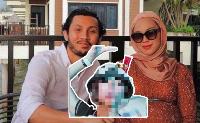 Bekas Isteri Luqman Hafidz ‘Tepek’ Muka Penyondol Di Instagram