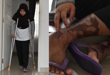 Majikan Seksa Pembantu Rumah Sampai Tempang, Paksa Makan Najis Anjing & Dakwa Pernah Diperkosa