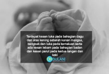 Sampainya Hati Kalian.. Bayi Lelaki Maut Dengan 89 Kesan Luka Dipercayai Didera