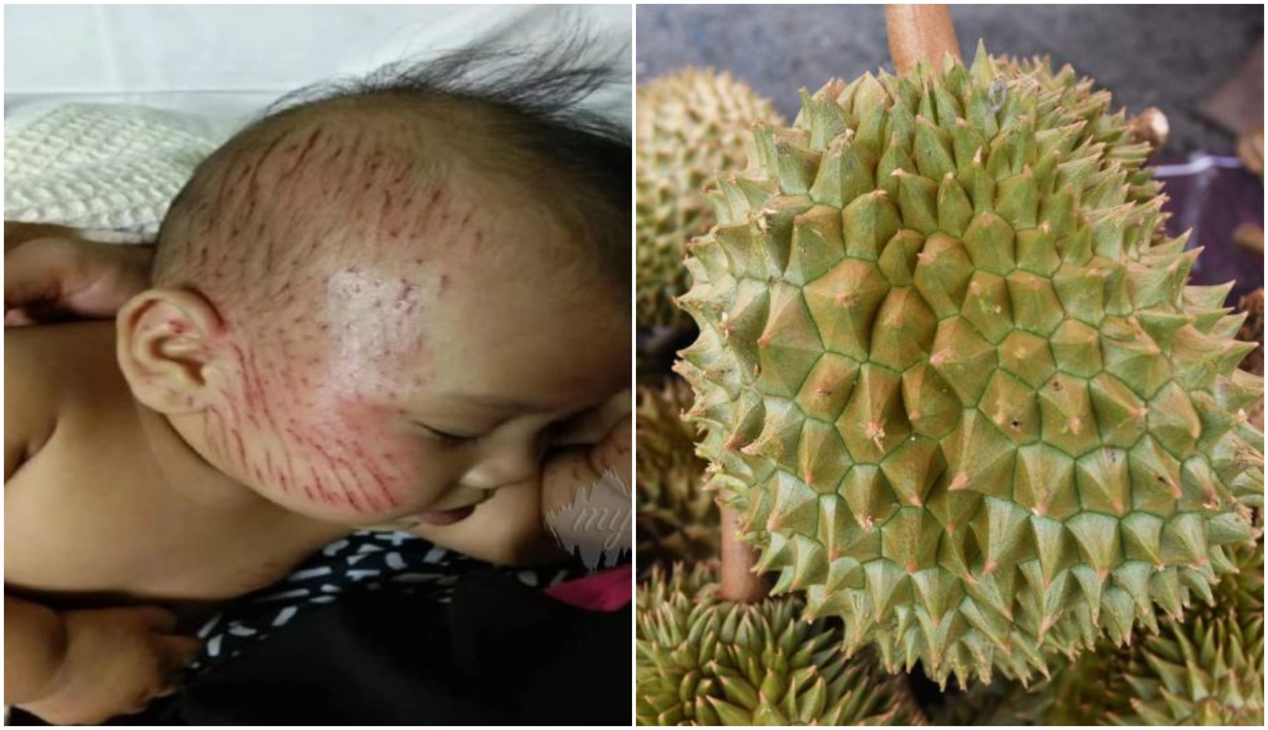 ‘Durian Itu Jatuh Kena Isteri Dulu, Melantun Ke Kepala Anak’ – Durian Jatuh Timpa Bayi 4 Bulan