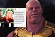 ‘Nampak Menyeksakan’- Pelakon Avengers ‘Thanos’ Buat Bekam, Ini Reaksi Pengikutnya Di Instagram