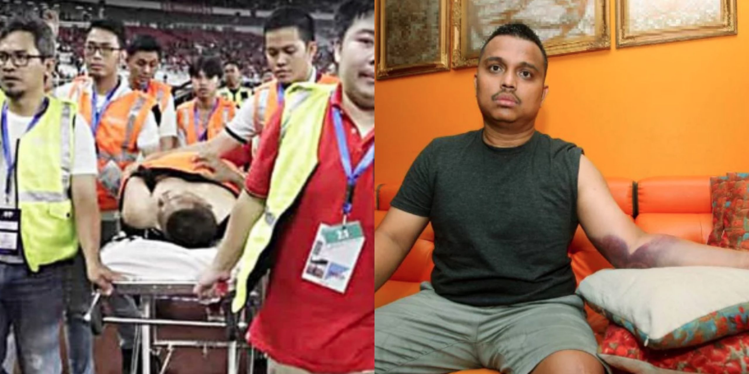 Penyokong Malaysia Patah Tangan Kongsi Detik Cemas Kena Serang Penyokong Indonesia