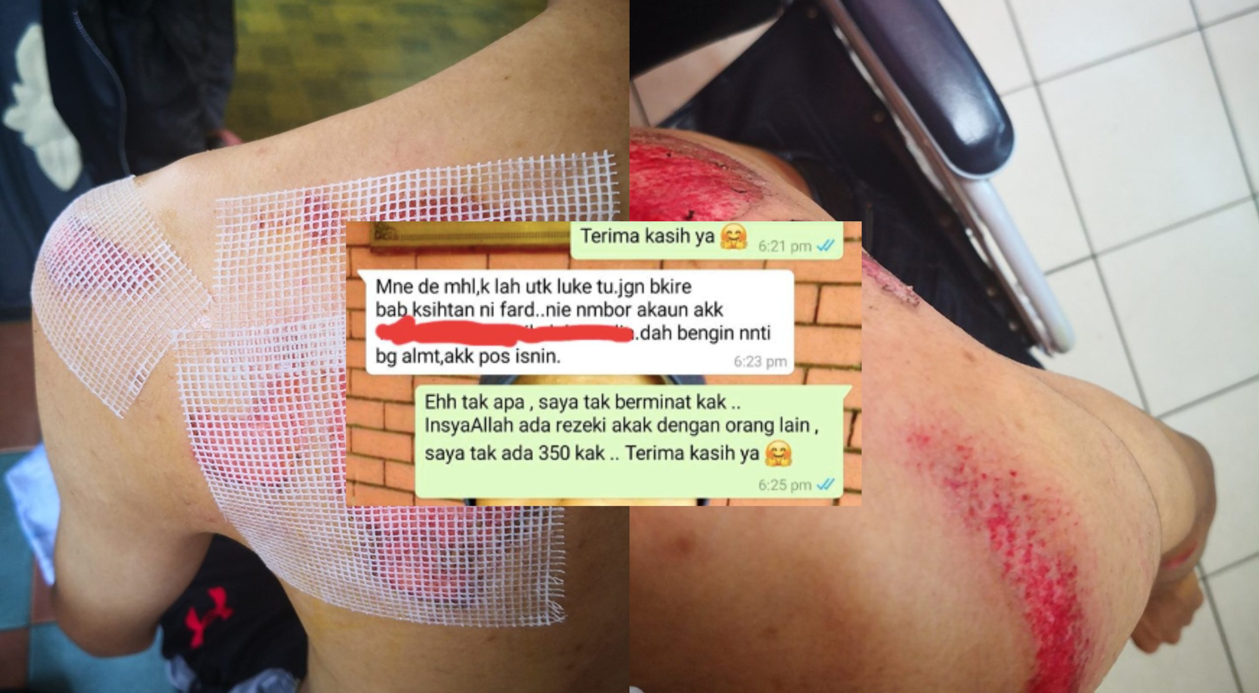 Dipaksa Beli Ubat Sembuh Luka, Bila Reject Ini Respon ‘Berang’ Jurujual.. Lawak!