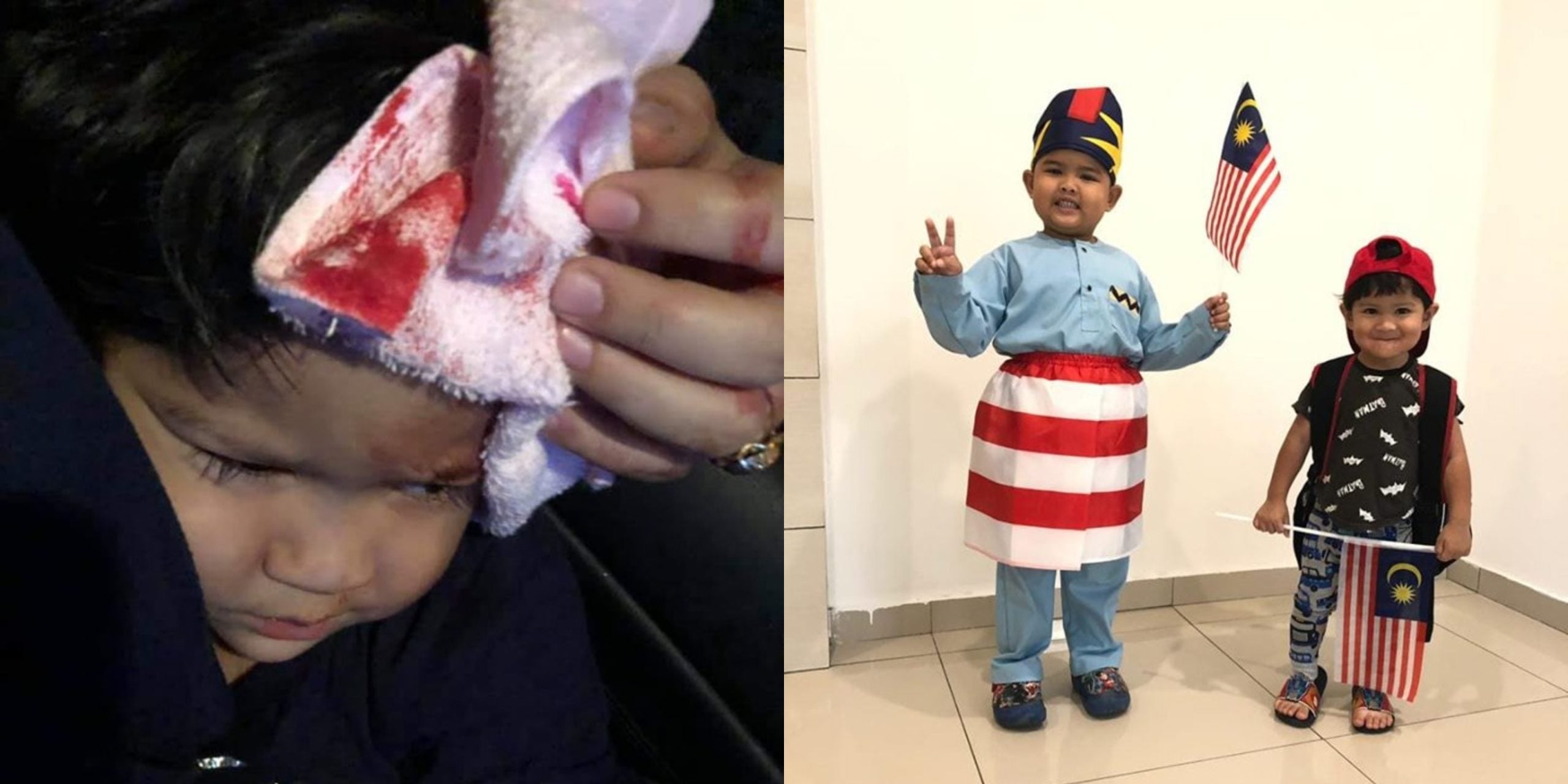 Kepala Anak Penuh Darah Terhantuk Atas Tar, Ini Yang Ibu Bapa Perlu Lakukan Bila Berdepan Situasi Begini