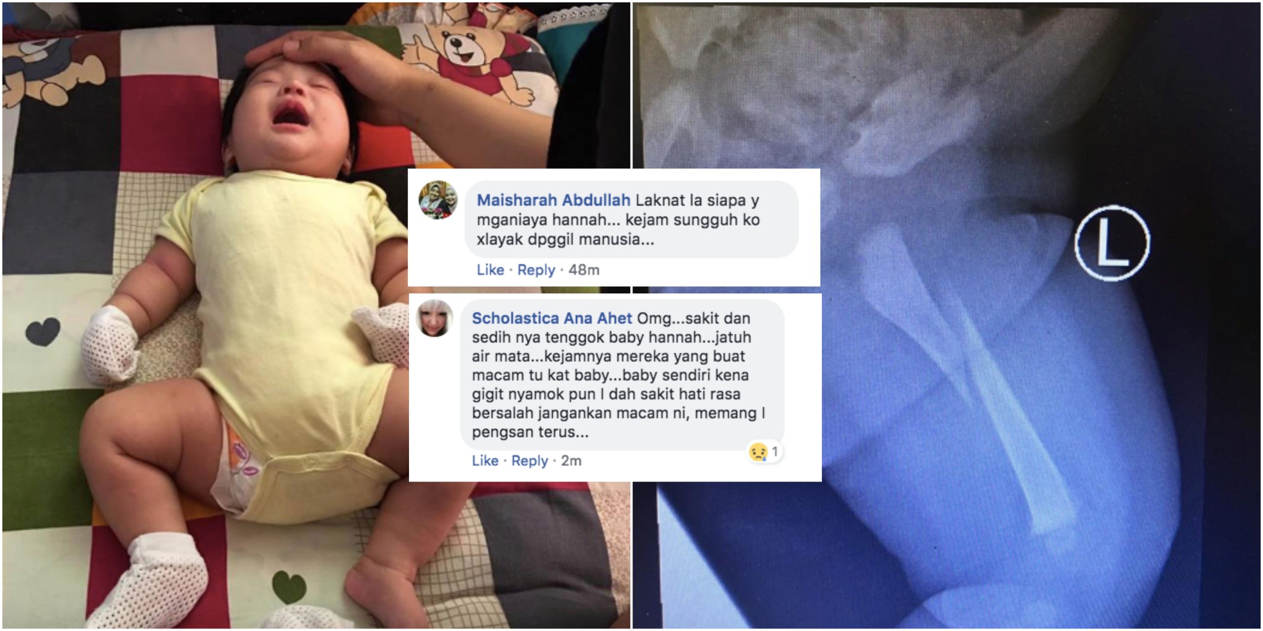 ‘Aku Hantar Anak Sihat, Dapat Balik Tulang Yang Paling Besar Dalam Badan Dia Patah..’