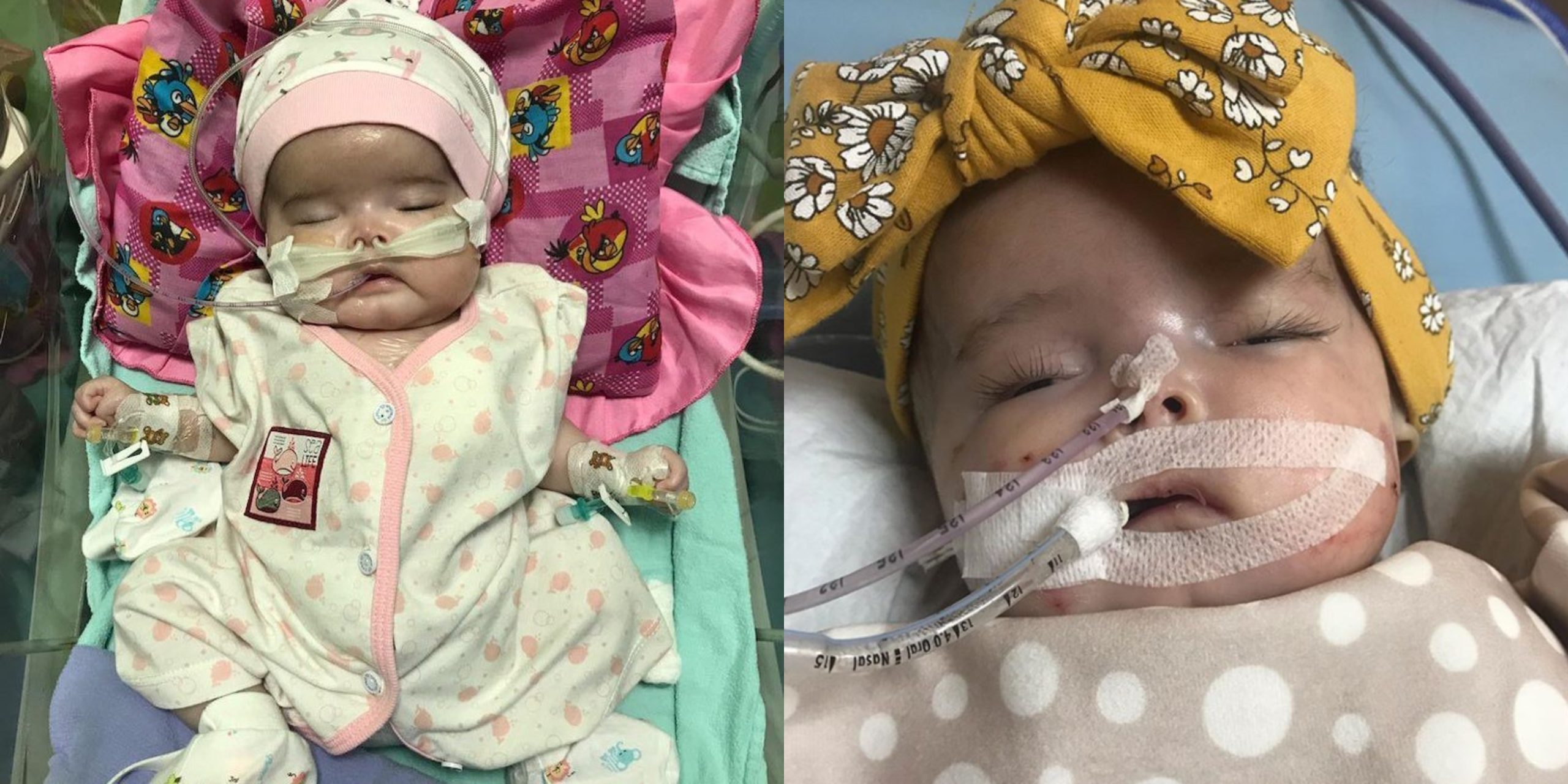Bayi Hidap Kanser Otak Tahap 4, Kyfa Nishka Meninggal Dunia