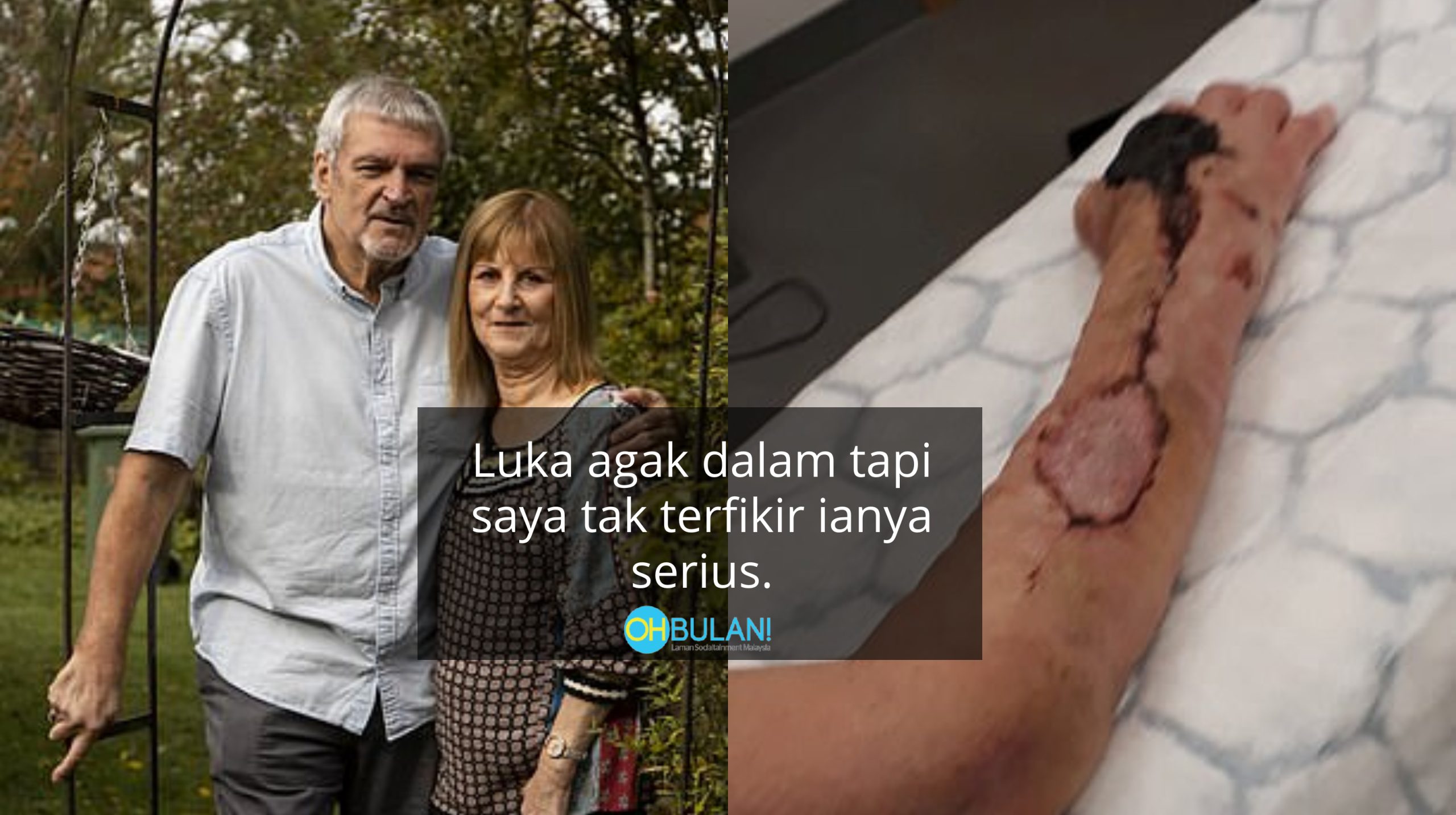 Gara-Gara Dicakar Kucing, Nenek 65 Tahun Koma & Terpaksa Jalani 8 Pembedahan